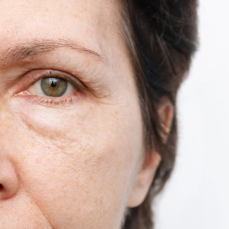 Understanding Alcohol and Face Puffiness