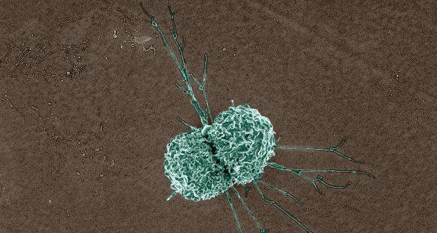 immune